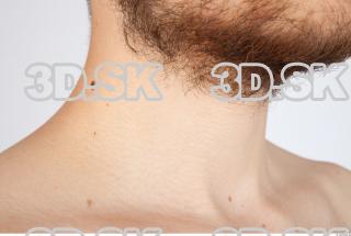 Neck texture of Charlie 0003